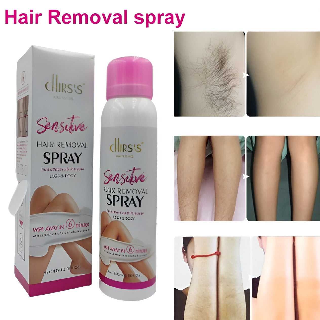 Chirs’s Fast Effective & Painless Hair Removal Spray