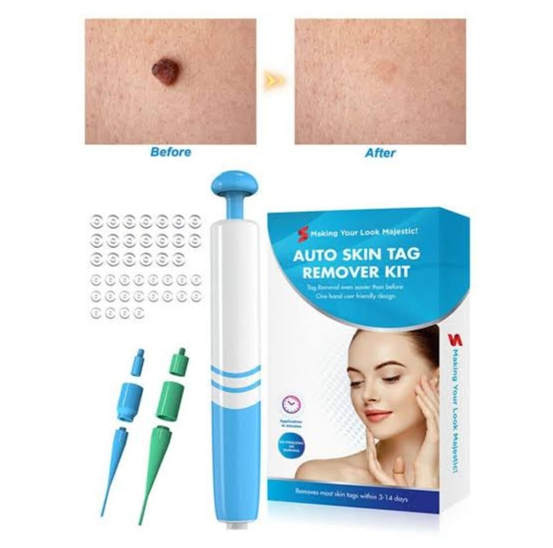 Auto Skin Tag/Warts Remover Painless