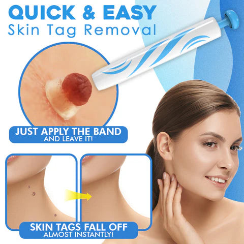 Auto Skin Tag/Warts Remover Painless